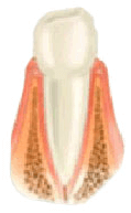Healthy gum - Periodontics, Sabatés Dental Clinic